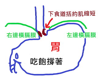 暫時性賁門鬆弛