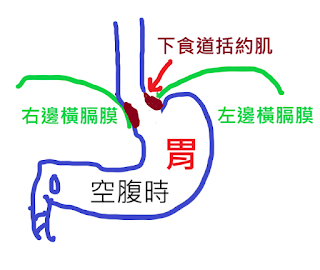 永久性賁門鬆弛