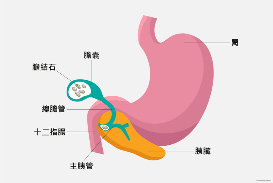急性胰臟炎原因
