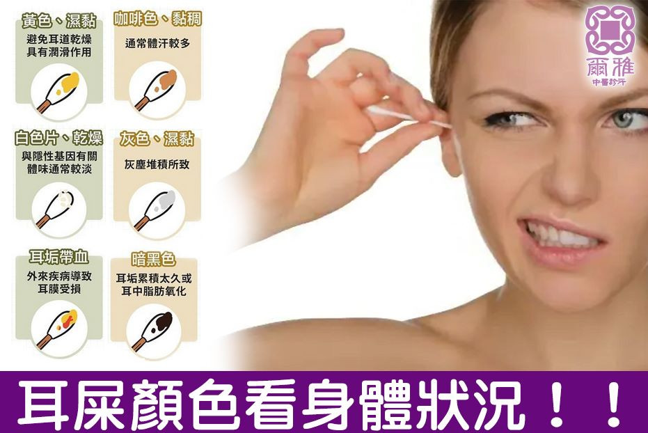 不同顏色的耳屎反映的身體情形