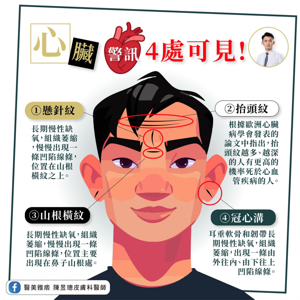 心臟警訊