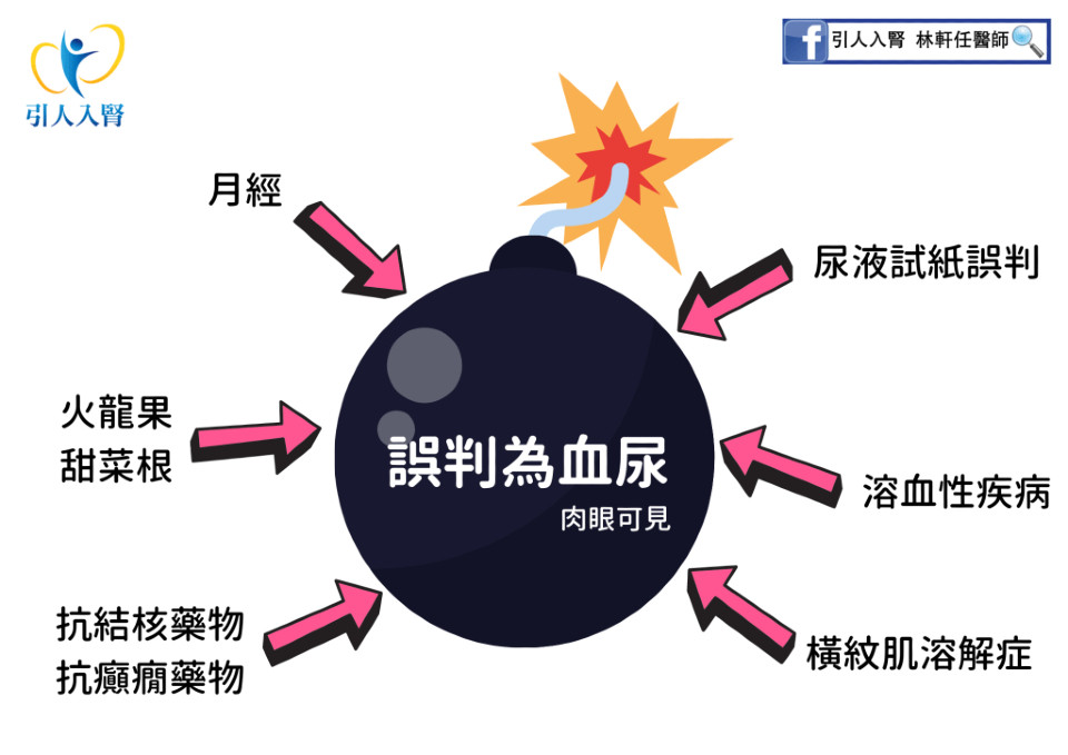 尿潛血原因