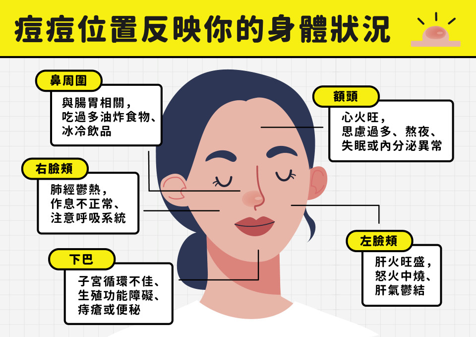 痘痘位置 下巴痘