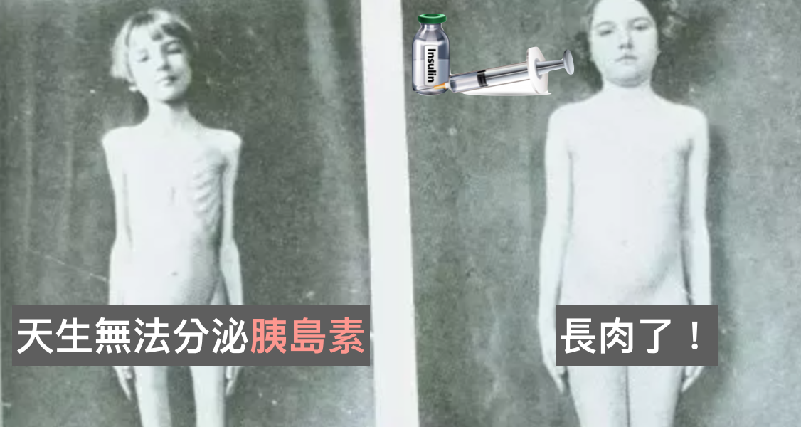 缺乏胰島素