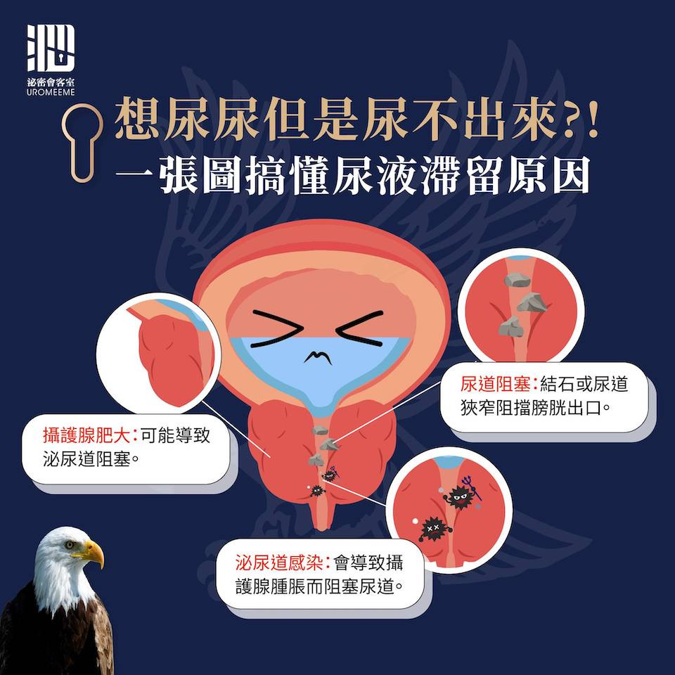 尿不出來原因