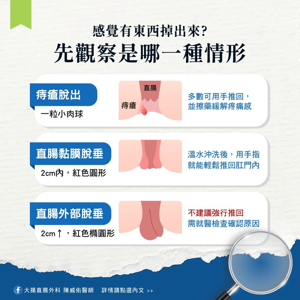脫肛怎麼辦