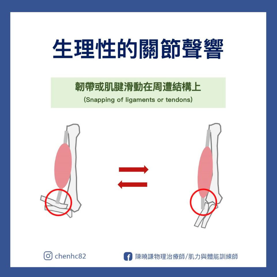 關節有聲音
