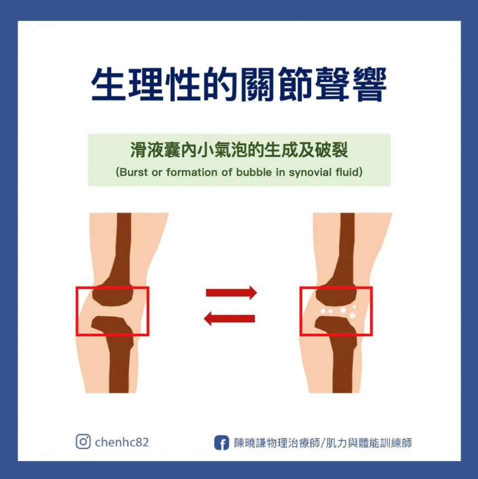 關節有聲音