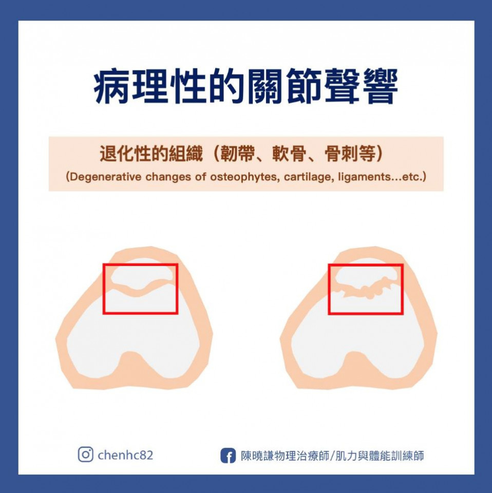 關節有聲音