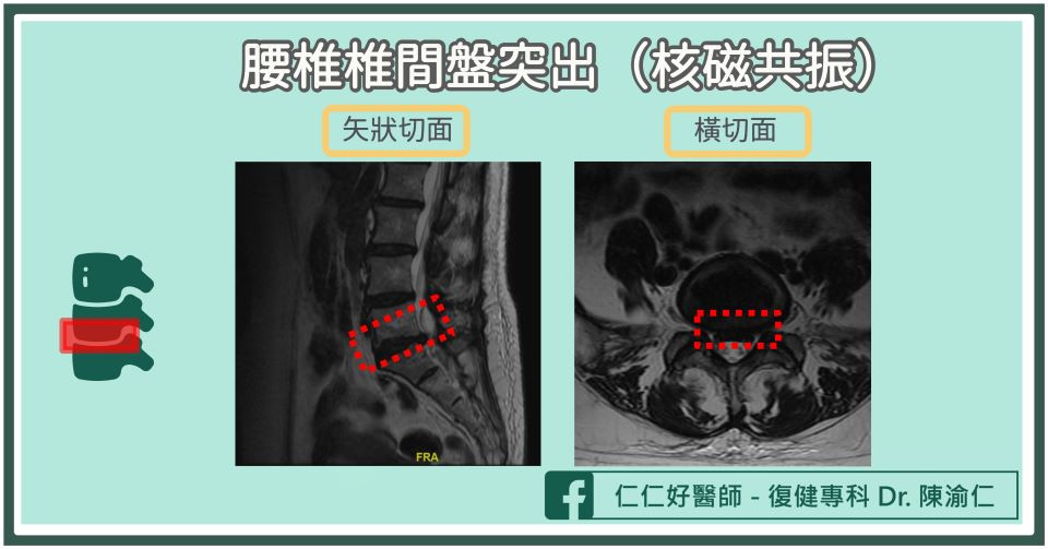 單車運動傷害