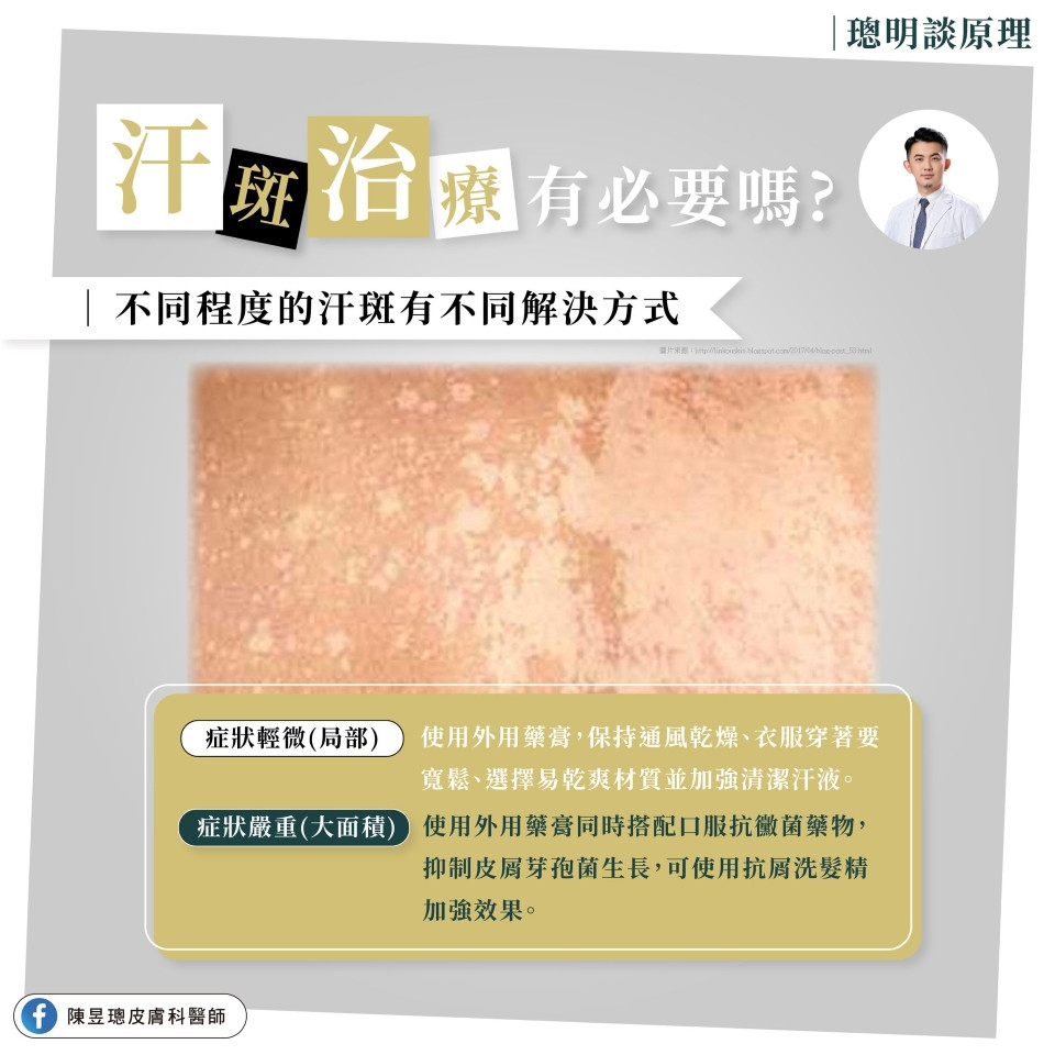 汗斑治療